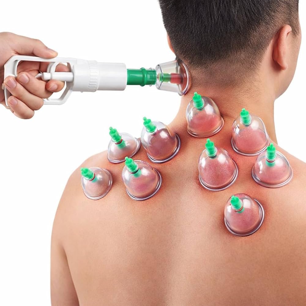 Hijama